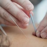 MEDICAL ACUPUNTURE