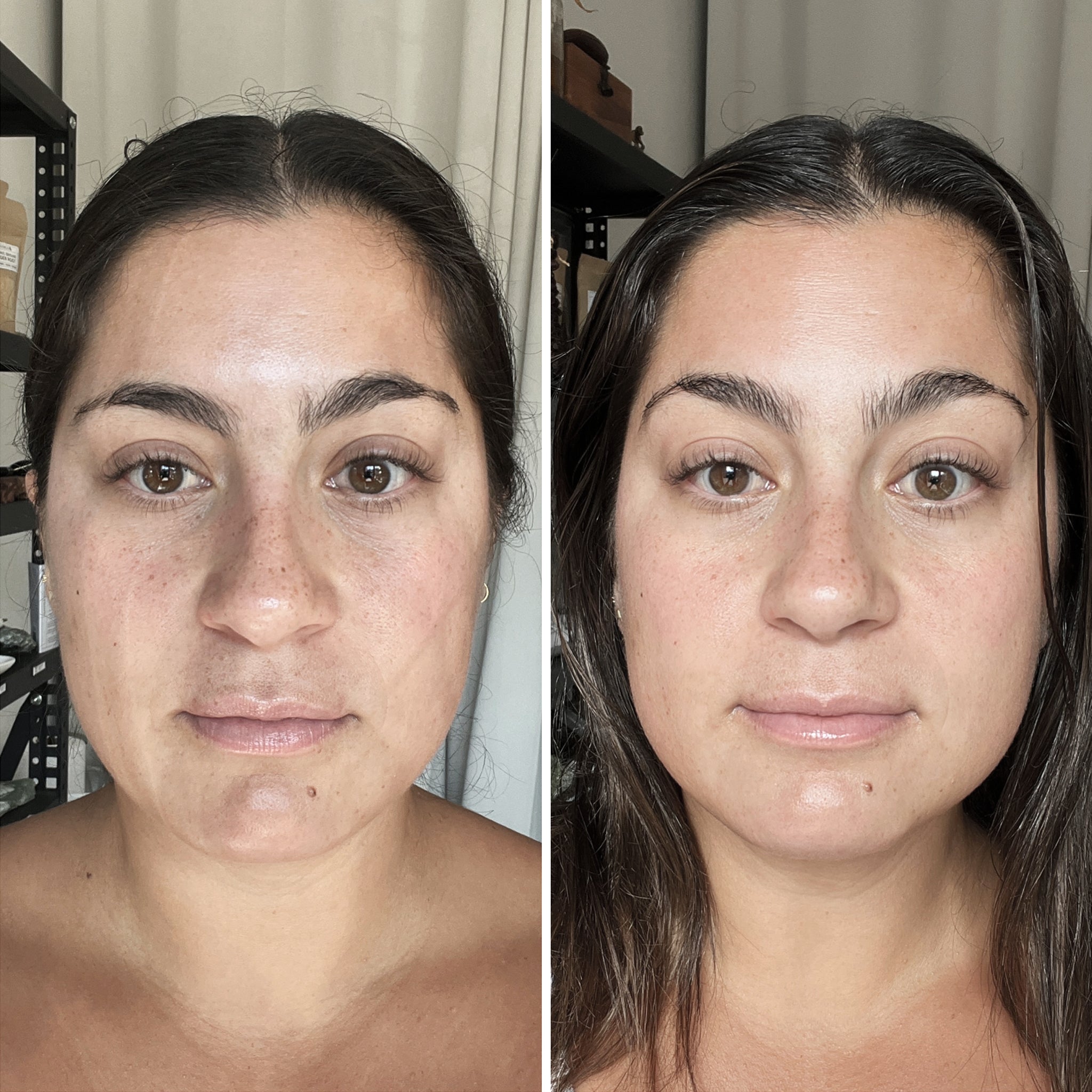 Before and after facial treatment