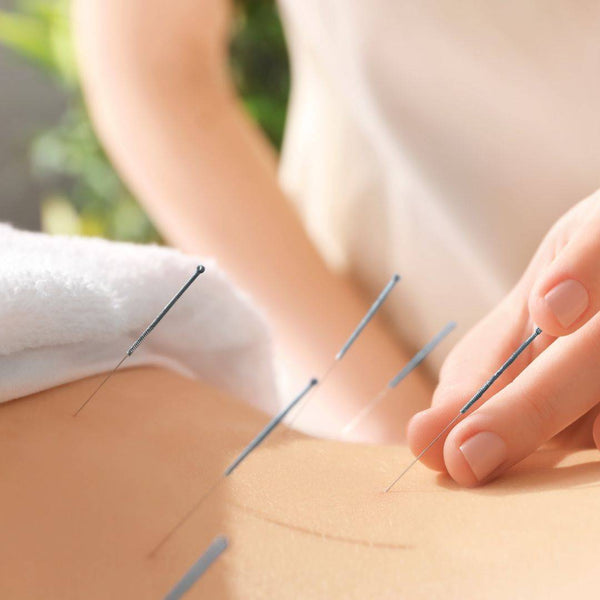 Medical Acupunture with Dr. Mary Chiu